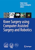 Télécharger le livre :  Knee Surgery using Computer Assisted Surgery and Robotics