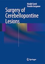 Télécharger le livre :  Surgery of Cerebellopontine Lesions