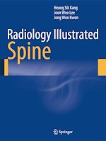 Télécharger le livre :  Radiology Illustrated: Spine