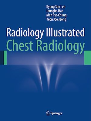 Téléchargez le livre :  Radiology Illustrated: Chest Radiology