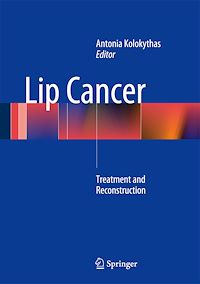 Télécharger le livre :  Lip Cancer