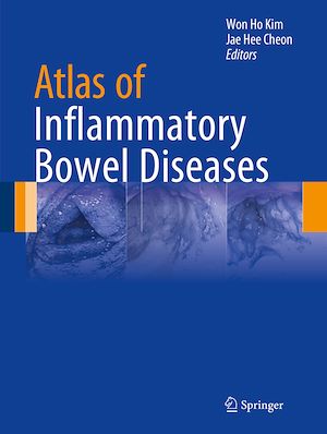 Téléchargez le livre :  Atlas of Inflammatory Bowel Diseases