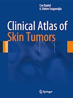 Télécharger le livre :  Clinical Atlas of Skin Tumors