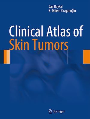 Téléchargez le livre :  Clinical Atlas of Skin Tumors