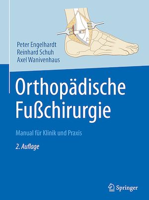 Téléchargez le livre :  Orthopädische Fußchirurgie