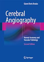 Télécharger le livre :  Cerebral Angiography