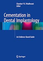 Télécharger le livre :  Cementation in Dental Implantology