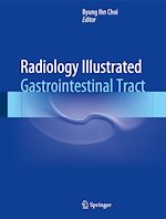 Télécharger le livre :  Radiology Illustrated: Gastrointestinal Tract