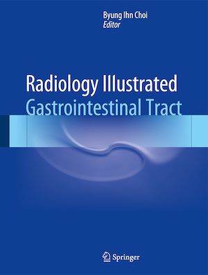 Téléchargez le livre :  Radiology Illustrated: Gastrointestinal Tract