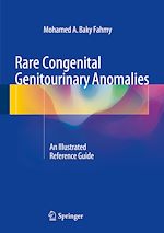 Télécharger le livre :  Rare Congenital Genitourinary Anomalies