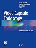 Télécharger le livre :  Video Capsule Endoscopy