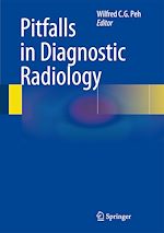 Télécharger le livre :  Pitfalls in Diagnostic Radiology