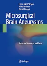 Télécharger le livre :  Microsurgical Brain Aneurysms