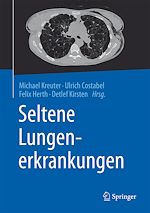 Télécharger le livre :  Seltene Lungenerkrankungen