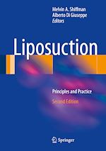 Télécharger le livre :  Liposuction