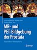Télécharger le livre :  MR- und PET-Bildgebung der Prostata