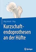 Télécharger le livre :  Kurzschaftendoprothesen an der Hüfte