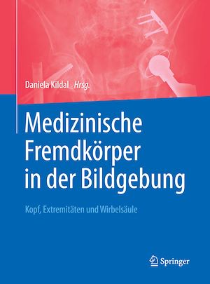 Téléchargez le livre :  Medizinische Fremdkörper in der Bildgebung