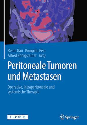 Téléchargez le livre :  Peritoneale Tumoren und Metastasen