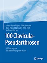 Télécharger le livre :  100 Clavicula-Pseudarthrosen