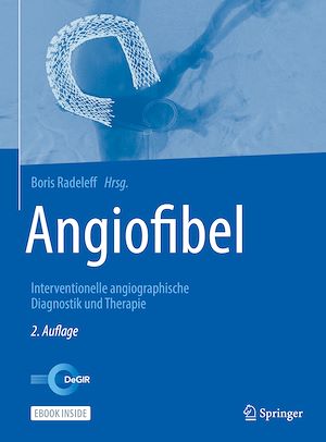 Téléchargez le livre :  Angiofibel