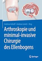 Télécharger le livre :  Arthroskopie und minimal-invasive Chirurgie des Ellenbogens