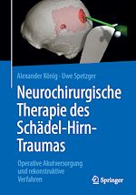 Télécharger le livre :  Neurochirurgische Therapie des Schädel-Hirn-Traumas
