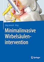 Télécharger le livre :  Minimalinvasive Wirbelsäulenintervention