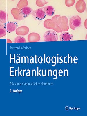 Téléchargez le livre :  Hämatologische Erkrankungen