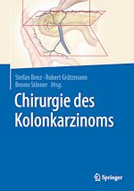 Télécharger le livre :  Chirurgie des Kolonkarzinoms