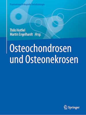 Téléchargez le livre :  Osteochondrosen und Osteonekrosen