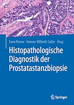 Télécharger le livre :  Histopathologische Diagnostik der Prostatastanzbiopsie