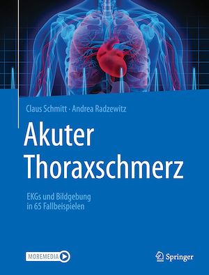 Téléchargez le livre :  Akuter Thoraxschmerz