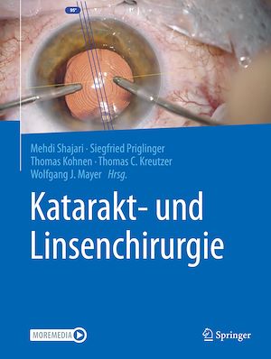 Téléchargez le livre :  Katarakt- und Linsenchirurgie