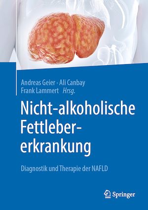 Téléchargez le livre :  Nicht-alkoholische Fettlebererkrankung