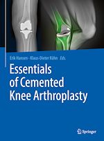 Télécharger le livre :  Essentials of Cemented Knee Arthroplasty