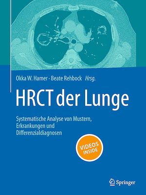 Téléchargez le livre :  HRCT der Lunge