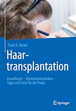 Télécharger le livre :  Haartransplantation