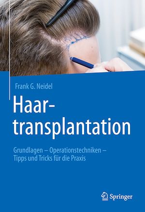 Téléchargez le livre :  Haartransplantation