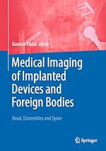 Télécharger le livre :  Medical Imaging of Implanted Devices and Foreign Bodies