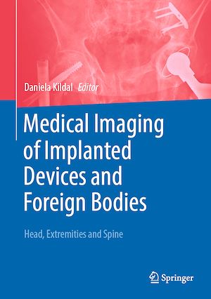 Téléchargez le livre :  Medical Imaging of Implanted Devices and Foreign Bodies