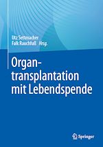Télécharger le livre :  Organtransplantation mit Lebendspende