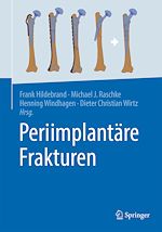 Télécharger le livre :  Periimplantäre Frakturen