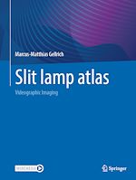 Télécharger le livre :  Slit lamp atlas
