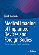 Télécharger le livre :  Medical Imaging of Implanted Devices and Foreign Bodies