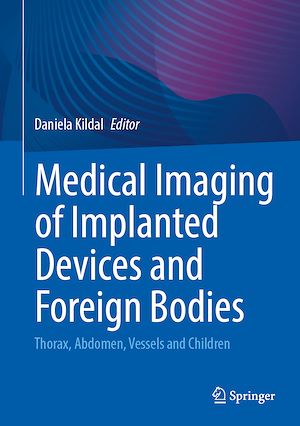Téléchargez le livre :  Medical Imaging of Implanted Devices and Foreign Bodies