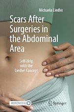 Télécharger le livre :  Scars After Surgeries in the Abdominal Area