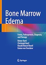 Télécharger le livre :  Bone Marrow Edema