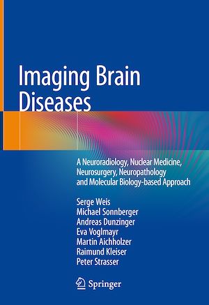 Téléchargez le livre :  Imaging Brain Diseases