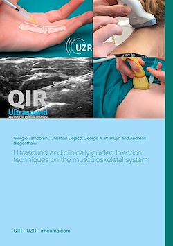 Télécharger le livre :  Ultrasound and clinically guided Injection techniques on the musculoskeletal system